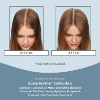 Scalp Revival™ Scalp Soothing Solutions Set