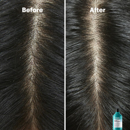 Scalp Advanced Anti-Dandruff Shampoo 300ml