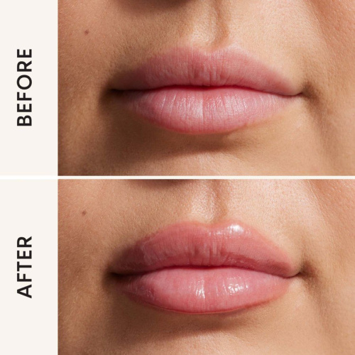 Lip Filler 001 Baby 5ml