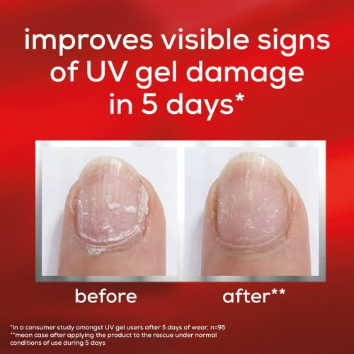 To The Rescue UV Gel Damage Nail Repair 13,5ml