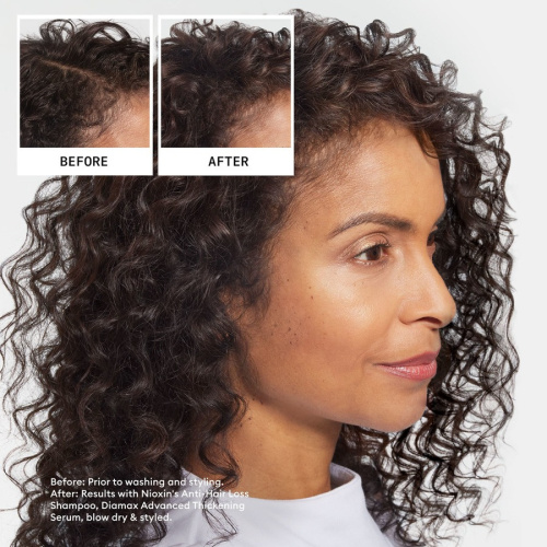 Anti-Hairloss Shampoo 240 ml