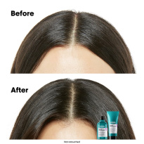 Scalp Advanced Anti-Discomfort Shampoo 300ml