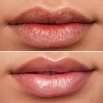 Lip Rehab Oil 3ml