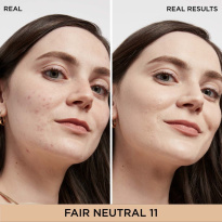 Bye Bye Dark Spots Concealer + Serum 6,7 ml ─ Fair Neutral 11