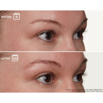 Brow Genius® Serum 3,5 ml