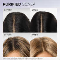 Elvital Hyaluron Pure Conditioner for Dehydrated Hair 300 ml